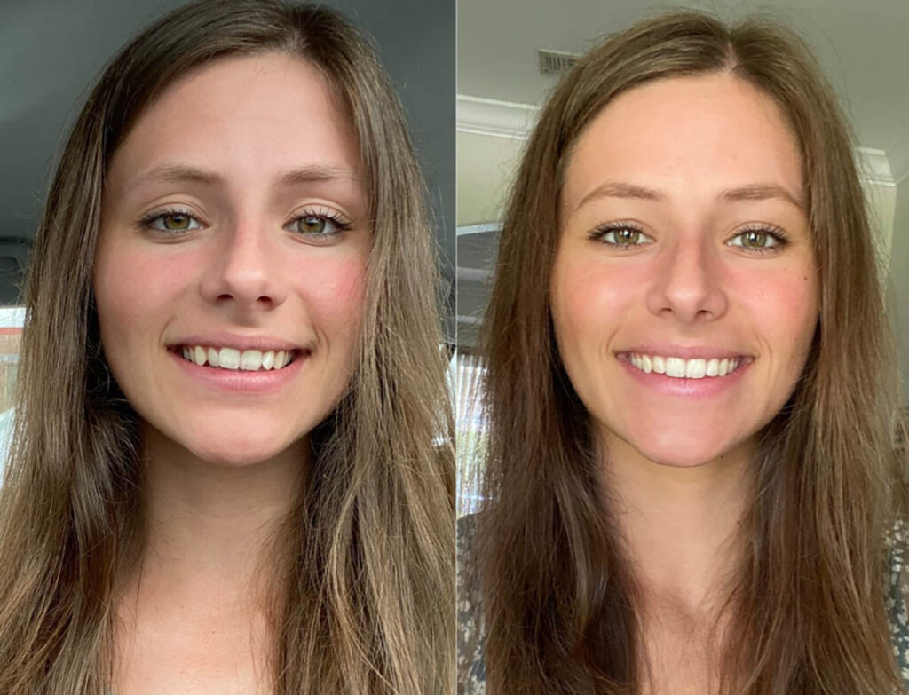 The Perfect Smile