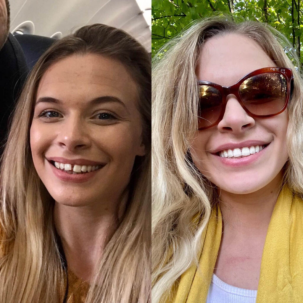 The Perfect Smile