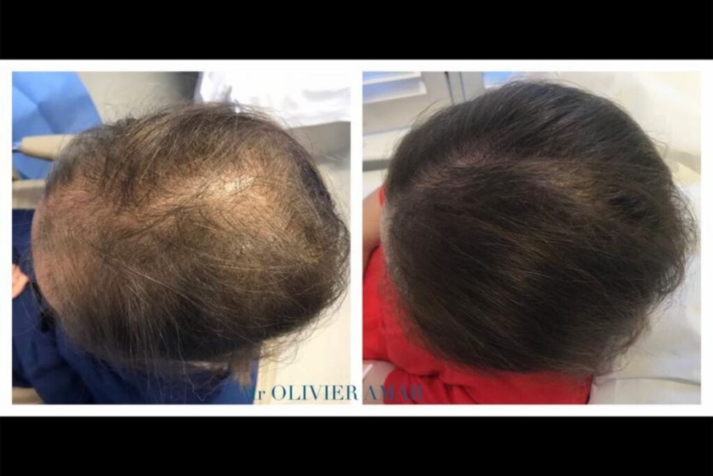 cosmetic treatments