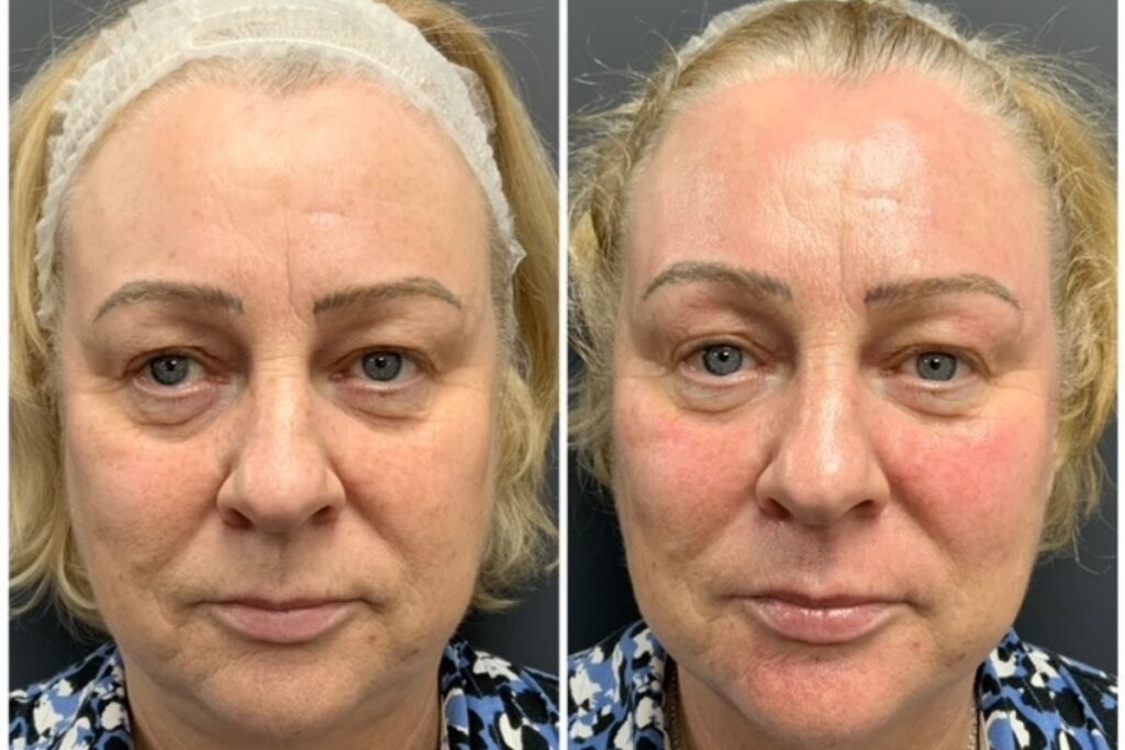 Yorkshire Skin Centre