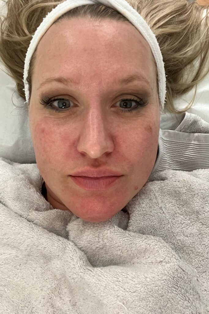 WOW facial