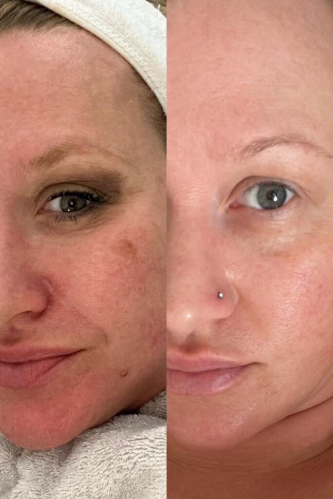 WOW facial