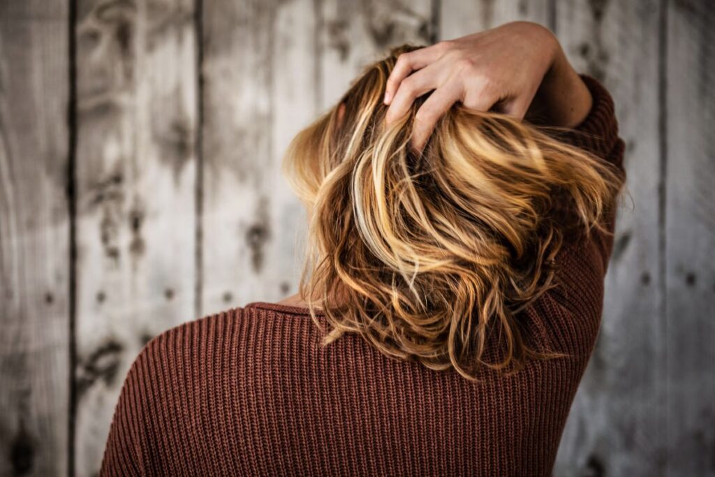adult acne