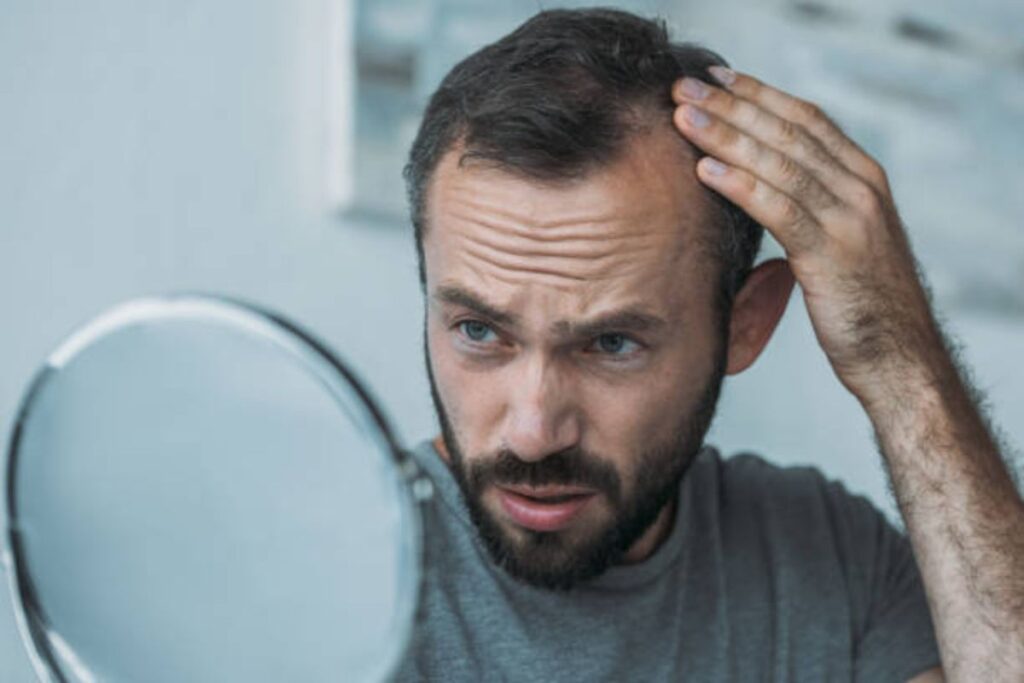 men's hair loss