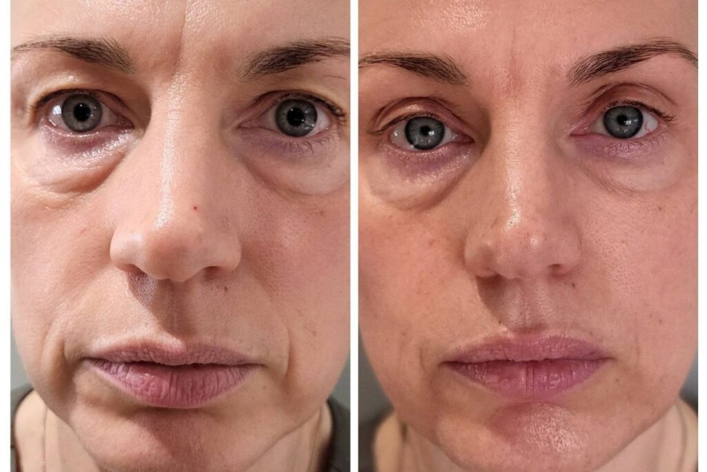 beauty promotions CACI