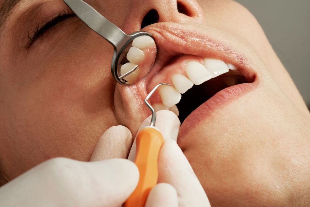 healthy teeth and gums