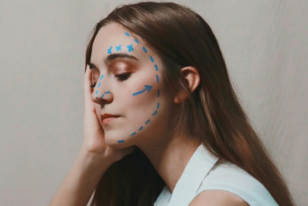 dermal fillers