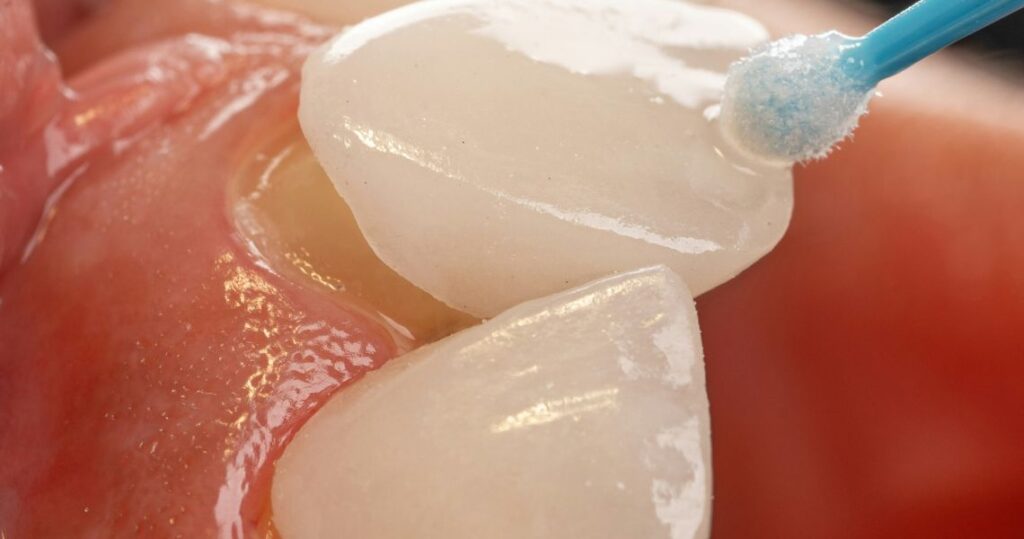 cosmetic dentistry Adelaide