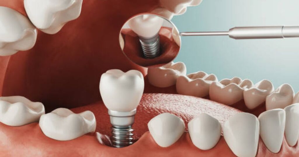 cosmetic dentistry Adelaide