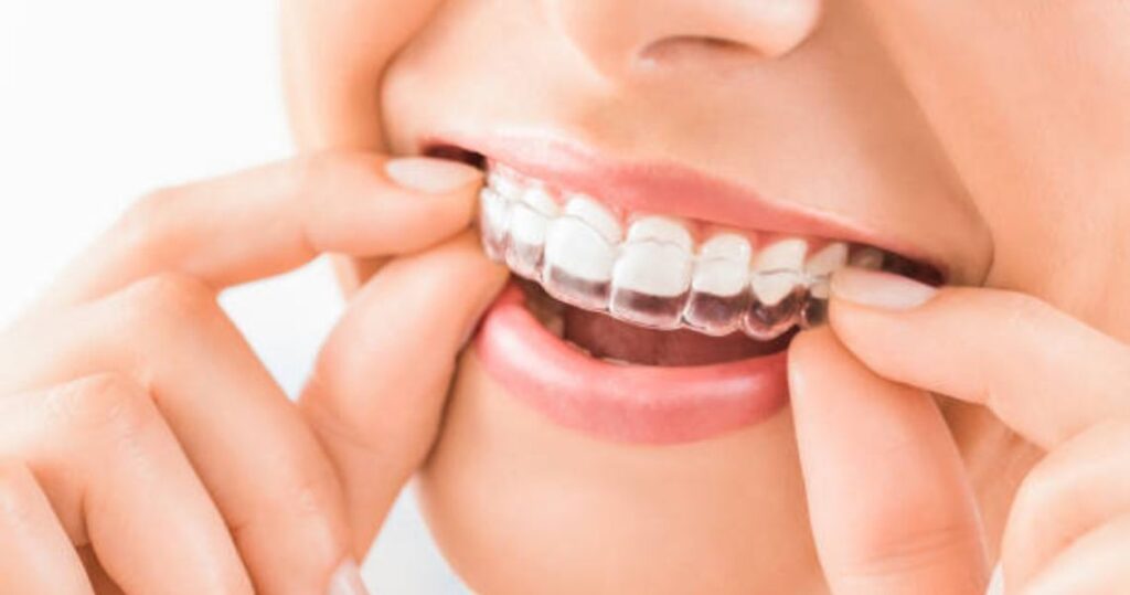 cosmetic dentistry Adelaide
