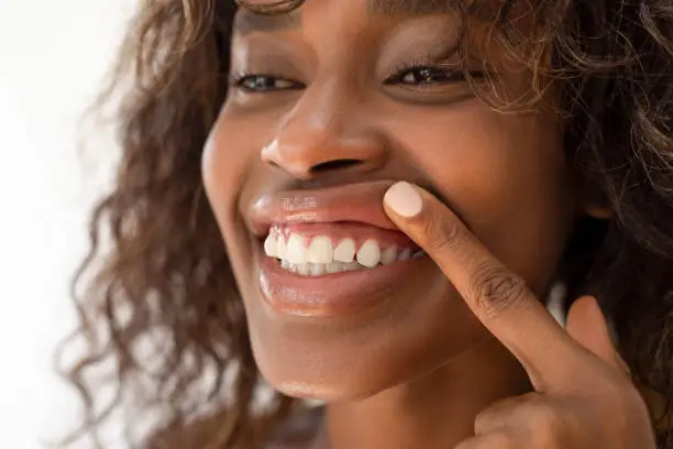 healthy gums