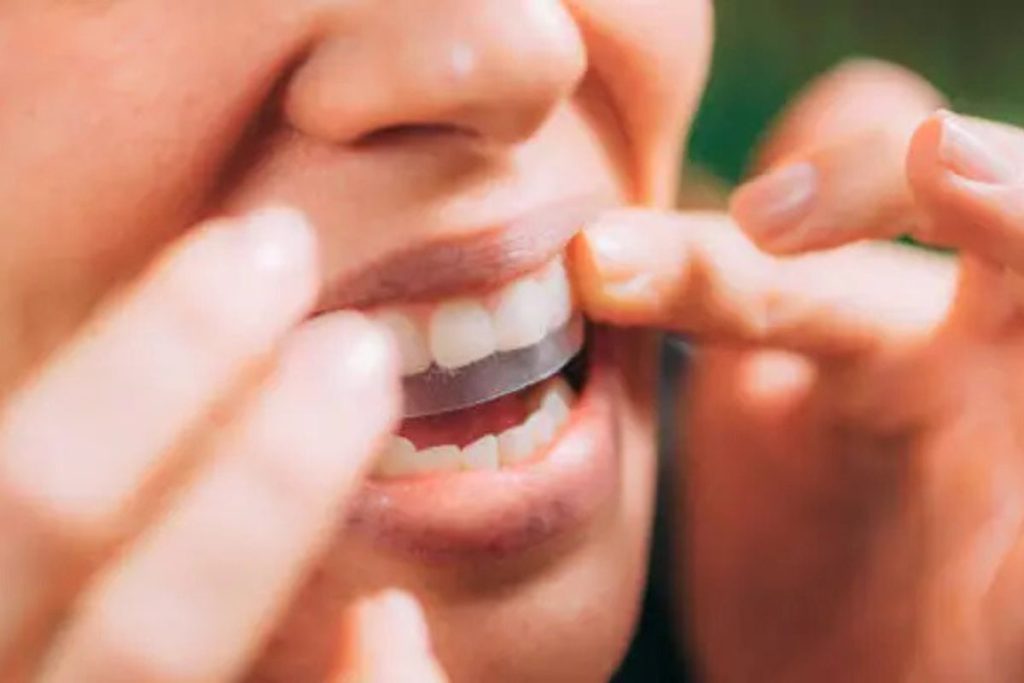 teeth whitening strips