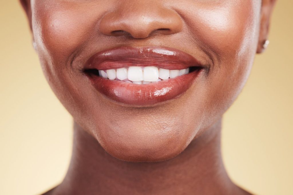 teeth whitening strips