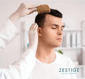 hair transplant
