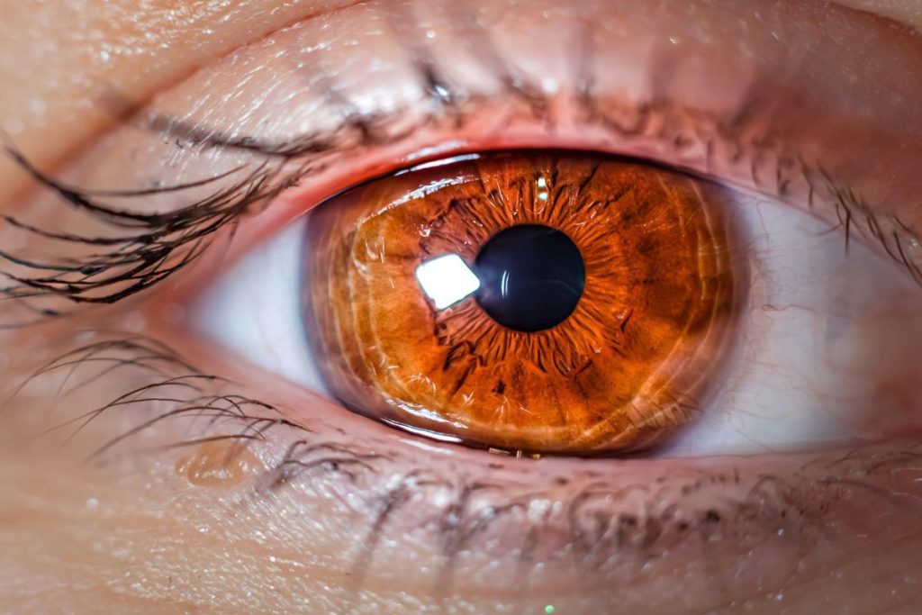 laser eye surgery in London
