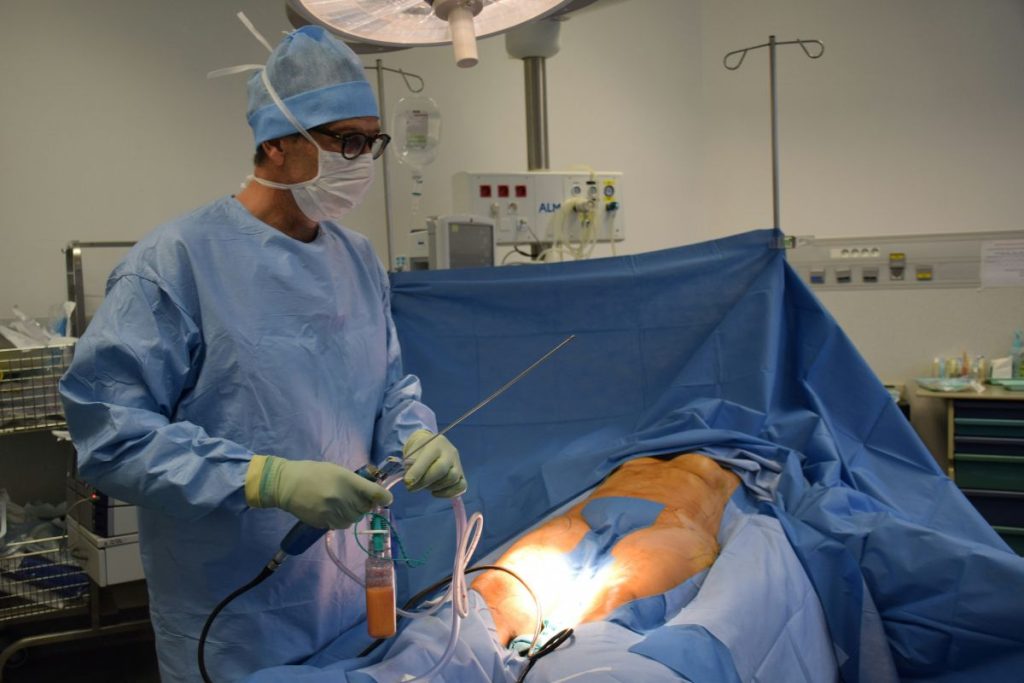 body enhancement liposuction