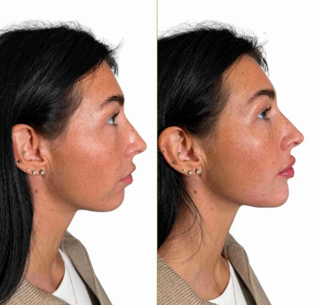 profile balancing Mayfair
