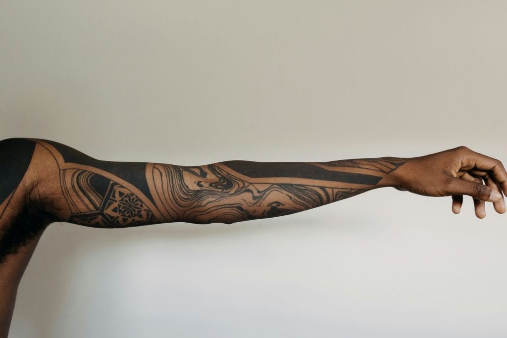 tattoo removal
